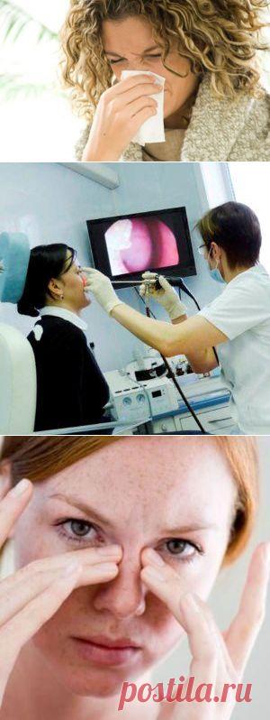 Лечение ринита народными средствами / Будьте здоровы