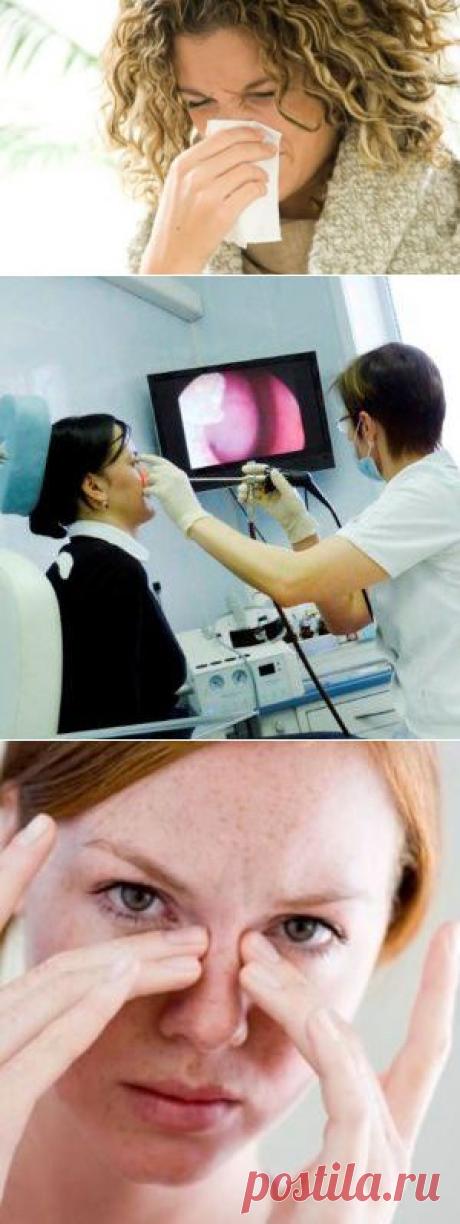 Лечение ринита народными средствами / Будьте здоровы