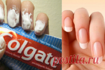 Я никогда не думал, что зубная паста может сделать столько полезных вещей. Эти 20 уникальных трюков Вам точно понравятся! 






Вот это список!
Кроме своего главного предназначения – чистить зубы – обычная зубная паста может помочь Вам сделать еще ряд кое-каких вещей! Эти 20 необычных способов применения зубной пасты то…