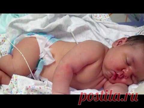 Родился ребенок ГИГАНТ - YouTube