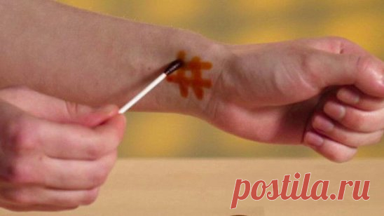Йодная сетка: проблемы, которые она способна решить
Простые линии (так называемая сетка), нарисованные на теле раствором йода, помогают облегчить целый ряд недомоганий за счет двойного действия, которое йод оказывает на организм.
1. Заболевания дыхательных путей
Использование раствора йода может существенно облегчить навязчивые симптомы простудных заболеваний и ускорить выздоровление. При насморке сеточку рисуют на крыльях носа и в области переносицы. Чтобы избавиться от сухого кашля, йодную с