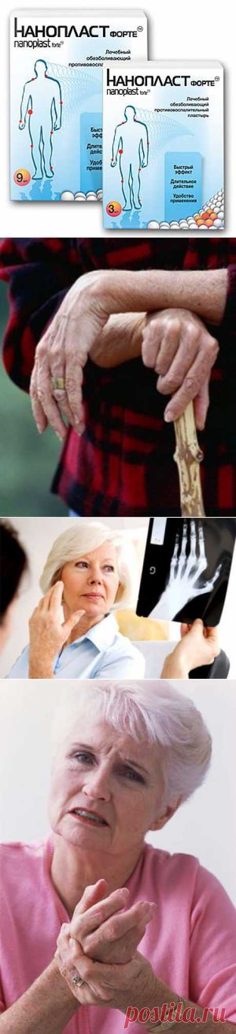 Подагра. Симптомы и причины подагры. Применение НАНОПЛАСТ форте для лечения подагры