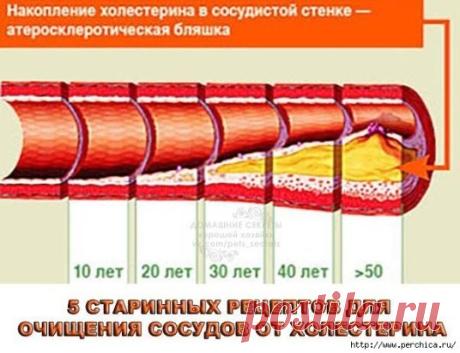 Народные рецепты для чистки сосудов
Организм человека вырабатывает 
самостоятельно в несколько раз больше холестерина, чем мы получаем его с
 пищей. Если в организме происходит какой-то сбой, в нем начинает 
вырабатываться еще большее количество холестерина. Он начинает 
откладываться прямо на стенках кровеносных сосудов – это грозит 
развитием атеросклероза. С этого следует, что ограничение в диете жиров 
не всегда оказывается достаточным.Советую подобрать себе народные 
средства, которые очища