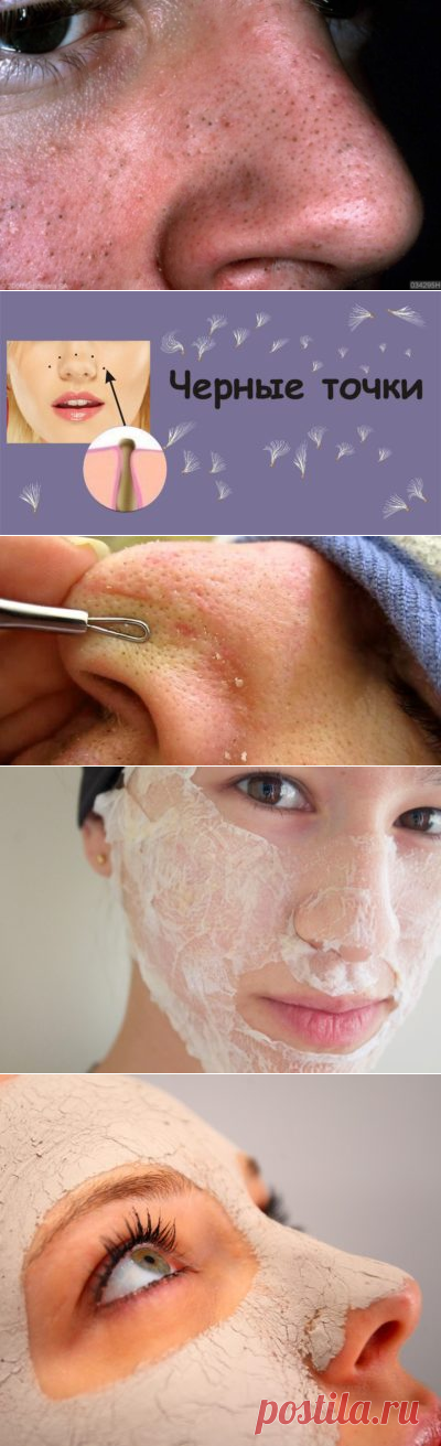 Как очистить кожу лица в домашних условиях от прыщей и черных точек