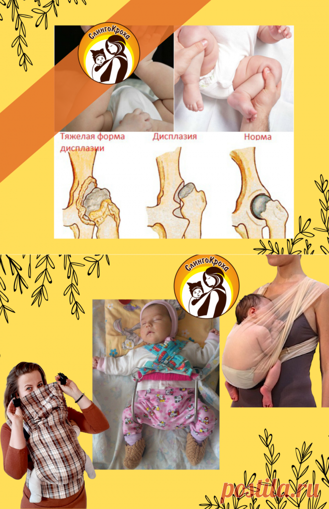Можно ли использовать слинг при дисплазии тазобедренных суставов | СлингоКроха | Яндекс Дзен