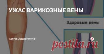 УЖАС ВАРИКОЗНЫЕ ВЕНЫ Что такое варикозные вены?
Артерии несут кровь от сердца к конечностям. Вены при помощи клапанов, которые пропускают кровь только в одну сторону, несут кровь обратно к сердцу. Когда имеется препятствие в венах и когда имеет место длительное повышение венозного давления, клапаны деформируются и не выполняют свою роль, позволяя крови беспрепятственно перемещаться обратно, тем самым еще больше повыша