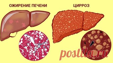 А что, если печень можно вылечить травами? 5 проверенных тысячами людей рецептов. -
