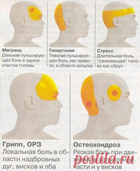 Головная боль