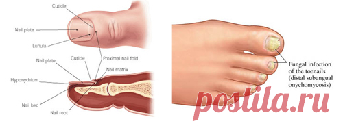 Профилактика и лечение грибка ногтей – эффективные народные и аптечные средства