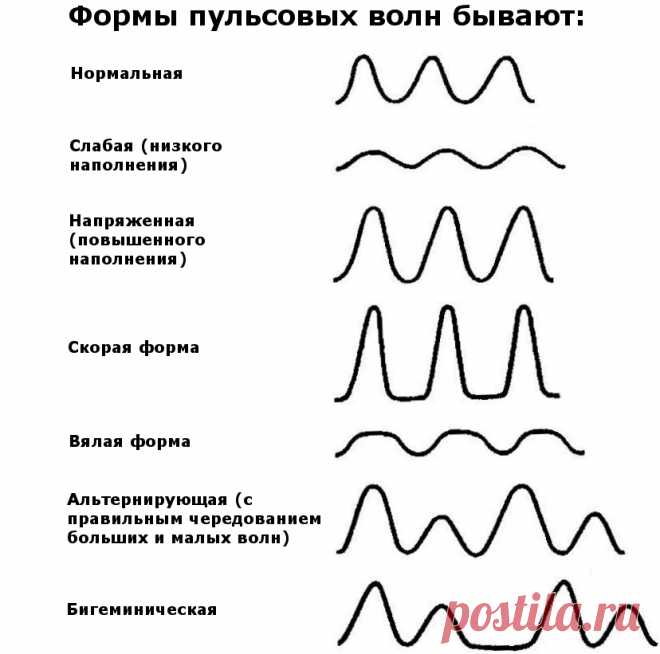 Нормальный пульс человека по годам, возрастам: таблица. Пульс — норма по возрастам у женщин, мужчин, детей: таблица. Какая норма пульса у взрослого человека в покое, физических нагрузках, у беременных? Где можно прощупать и измерить пульс?