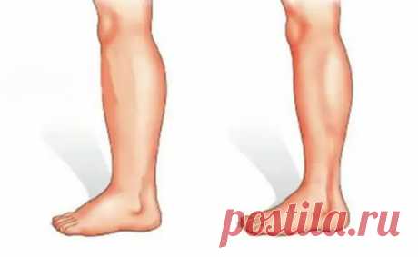 Ходьба не отрывая стоп: активный лимфодренаж, выводим лишнюю воду и отеки - ПолонСил.ру - социальная сеть здоровья - Медиаплатформа МирТесен