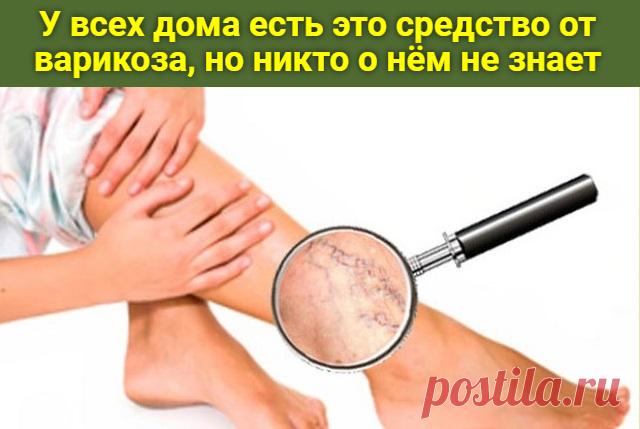 У всех дома есть это средство от варикоза, но никто о нем не знает — Journal women❜s