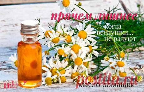 Ромашка для лица. Отвар, настой, лед, масло из ромашки | Блог Ирины Зайцевой