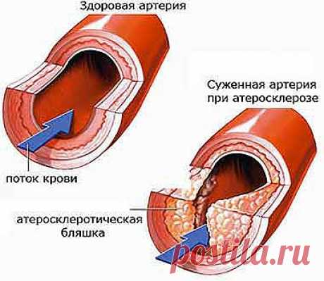 сообщение Профессор_Селезнёв : 10 продуктов, которые помогут сохранить здоровье сосудов (11:33 31-10-2013) [4524271/297795660] - tropina.kerch@mail.ru - Почта Mail.Ru