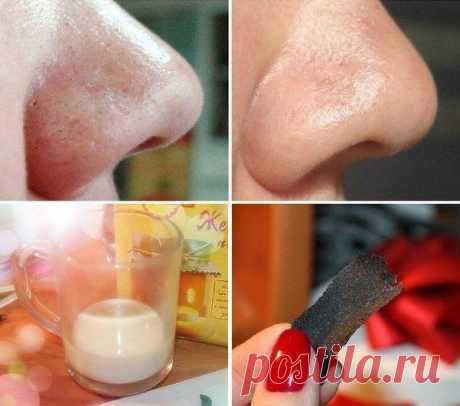 Убираем поры на лице | Делаем сами