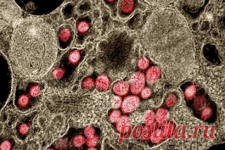 Выявлен признак скорого слабоумия. Проблемы со слухом у взрослых могут быть связаны с высоким риском слабоумия. К такому выводу пришли ученые Университета Оксфорда в Великобритании и Университета Гамбурга в Германии, в исследовании которых приняли участие более 80 тысяч взрослых в возрасте старше 60 лет.