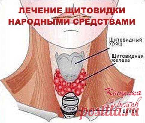 ЛЕЧЕНИЕ ЩИТОВИДКИ НАРОДНЫМИ СРЕДСТВАМИ.
Рецепт 1.
Сок 10-ти лимонов, 10 измельченных головок чеснока, 1 литр натурального меда. Настаивайте смесь в течение 7-ми дней. Пейте по 4 ч. л. 1 раз в день, по ложечке, не спеша.
Рецепт 2.
Натрите 1 лимон вместе с цедрой, перемешайте с сахаром и принимайте за 30 минут до еды по 1 ч. л. 3 р. в день.
Рецепт 3.
В 0.5 литровую банку поместите скорлупки 14-ти грецких орехов, заполните водкой и настаивайте 7 дней в темном тёплом месте. Ба...