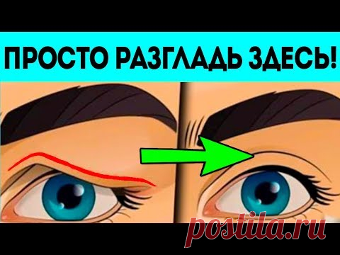 Подтягиваем нависшие веки без пластики. Те кто делают предпочитают не разглашать это.