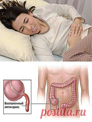 Аппендицит: не терпит, когда его терпят!