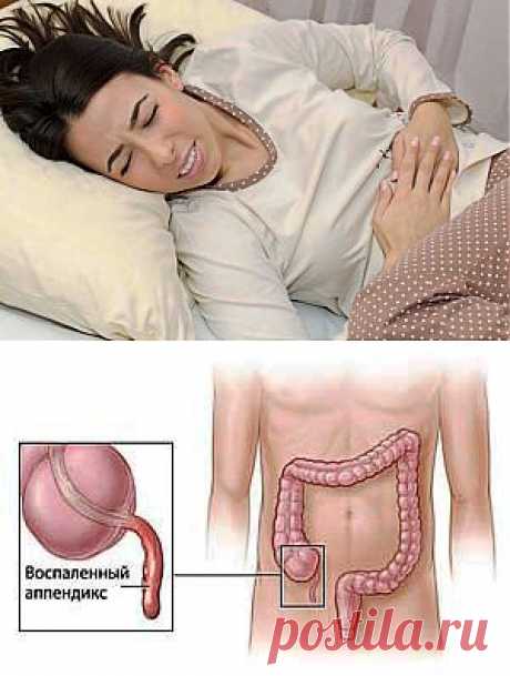 Аппендицит: не терпит, когда его терпят!