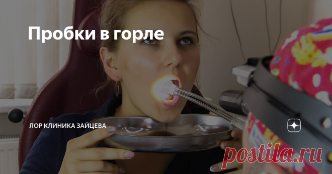 Пробки в горле Вот и наступили холода, а вместе с ними число пациентов с пробками в миндалинах увеличилось в геометрической прогрессии. Поэтому будет совсем не лишним напомнить, что такое пробки, как правильно расценить своё состояние в горле и, главное, как с этим бороться.
Пробки в миндалинах – это не остатки еды, как думают некоторые, а скопление спрессованного стрептококка с погибшими лейкоцитами. Это самый