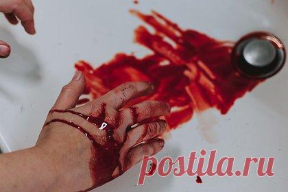 19-летняя девушка приняла редкое смертельно опасное заболевание за обычную сыпь. Жительница США Джулиана Паскарелла заметила странную сыпь на теле, которую посчитала безобидной. Однако красные пятна оказались признаком опасного заболеванием крови — иммунной тромбоцитопенической пурпурой. Американка чудом избежала смерти. Без обращения в больницу у нее могло начаться внутреннее кровотечение.