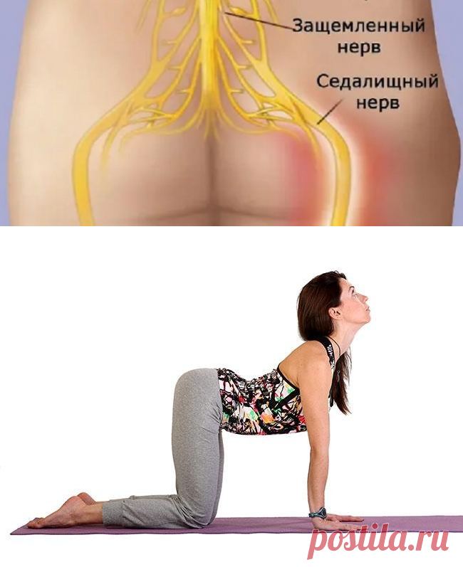 Чем снять боль при защемлении нерва » ЧапЧап