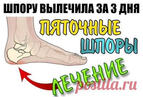 ШПОРУ ВЫЛЕЧИЛА ЗА 3 ДНЯ
Поделюсь рецептами от пяточных шпор. Прошлым летом на юге после ванн у меня так разболелась нога, что я не знала, куда ее деть. Пятка горела огнем. Приехав домой, побежала к хирургу. Молодая врач сделала снимок и объявила, что у меня после ванн обострилась пяточная шпора. Дала мне какую-то «памятку» - и все. Я поняла, что надо самой лечиться. Обратилась к народной медицине - стала искать рецепты от шпор. Все, что нашла, выписала и посылаю вам. Ведь ...
