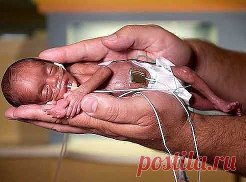 РЕБЁНОК ВЫЖИВШИЙ В РЕЗУЛЬТАТЕ АБОРТА / Новые дети