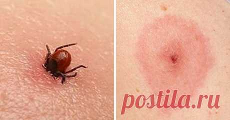 Эти насекомые могут быть опасны: каждый должен знать, как выглядят их укусы Близится лето, а вместе с ним и надоедливые насекомые, укусы которых нестерпимо чешутся и краснеют. Но сколько насекомых, столько и разных укусов. Поэтому важно знать, как выглядит тот или иной, чтобы оказать своевременную помощь себе или другому человеку...