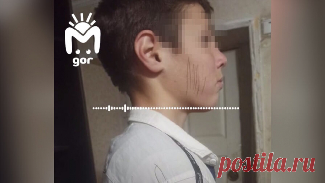 Педагог изрисовала ручкой лицо ученику из-за непослушания. В Заманкульской средней школе в Северной Осетии педагог наказала ученика за шалость, изрисовав ему лицо шариковой ручкой. Об этом сообщает Telegram-канал Mash Gor. Инцидент произошел в средней школе в Заманкульском районе и попал на ...