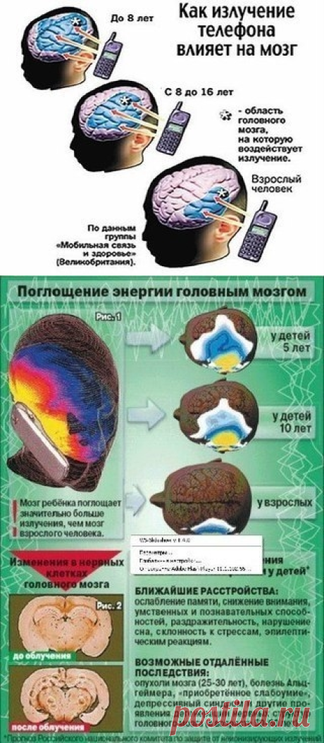 Мобильный телефон и рак мозга
