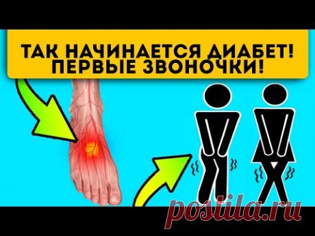 Еще не диабет, но … 16 признаков высокого сахара + 8 признаков диабета