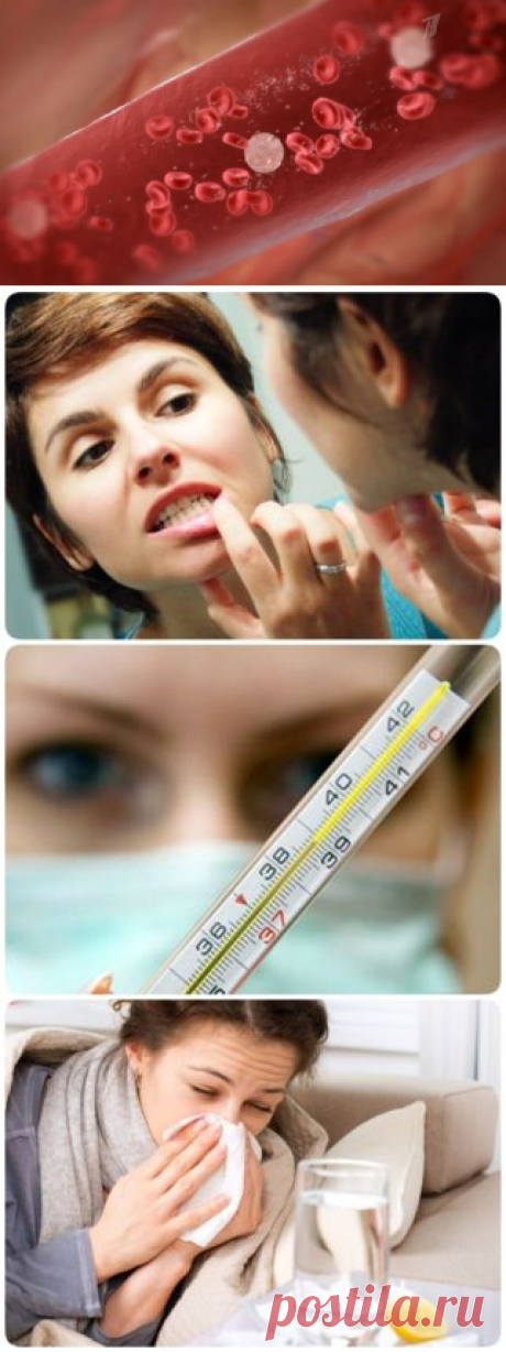 16 молчаливых симптомов лейкемии, которые легко не заметить