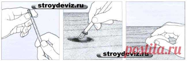 Удаление ожогов