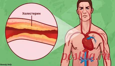 8 способов борьбы с холестерином и гипертонией — Сад Заготовка