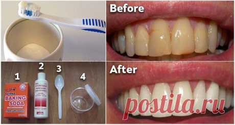 Как избавиться от зубного налета и отбеливать зубы без дорогостоящих процедур Проверенный метод! Налет — бесцветная липкая пленка бактерий, которая накапливается на зубах. Если его не лечить, он продолжает расти и затвердевает в