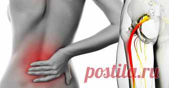 Воспаление седалищного нерва: симптомы и лечение Седалищный нерв — это крупнейший нерв нашего организма. Если у человека болит седалищный нерв, то это значит, что у него развился ишиас. Ишиас (или защемление седалищного нерва) проявляется болью различной степени в пояснично-крестцовой области или в ягодице, распространяясь на всю заднюю поверхность бедра, голени и стопы. От боли может страдать и одна нога, и сразу обе. В некоторых случаях боли при ишиасе может не быть, а м...