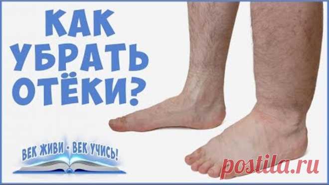 ОТЁКИ. Причины отёков. Как убрать отёки. Задержка Воды. Фролов Ю. А . Часть 1.
