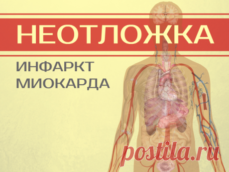 Как начинается инфаркт: просто о сложном. Признаки, стадии, осложнения Инфаркт миокарда – опасная клиническая форма ишемической болезни сердца. Из-за недостатка кровоснабжения сердечной мышцы на одном из ее участков (левом или правом желудочке, верхушке сердца, межжелудочковой перегородке и др...