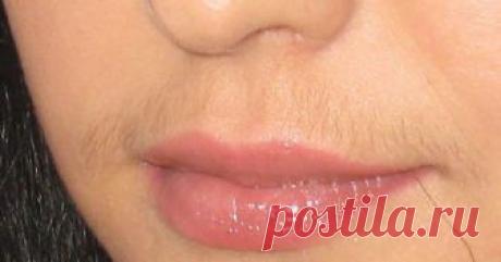 Как навсегда избавиться от женских "усиков" | Golbis