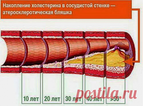 Лимон и чеснок для сосудов | Друг пенсионера
Сосуды в нашем организме часто на­иболее уязвимая часть. Дело в том, что при современном ритме жизни очень сложно человеку уделять доста­точно внимания, например, своему питанию.
