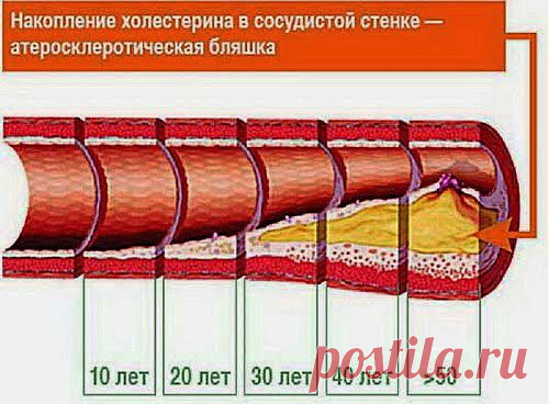 Лимон и чеснок для сосудов | Друг пенсионера
Сосуды в нашем организме часто на­иболее уязвимая часть. Дело в том, что при современном ритме жизни очень сложно человеку уделять доста­точно внимания, например, своему питанию.