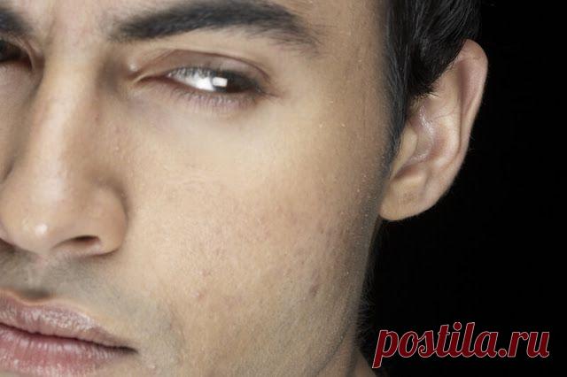 Зависть — гниль для костей