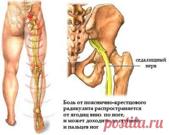 Седалищный нерв