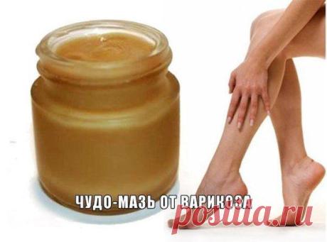 ЧУДО - МАЗЬ ОТ ВАРИКОЗА!
У моей мамы ужасный варикоз. И врачи сказали - только операция. А она - ни в какую. Искали способы, покупали мази дорогущие, ничего не помогало. Но как-то мне одна знакомая рассказала ПРО МАЗЬ, СДЕЛАННУЮ В ДОМАШНИХ УСЛОВИЯХ, которая вылечила ей ноги! У нее также был варикоз, и в последнее время даже язвочки на ногах, темные пятна. Хиру%D