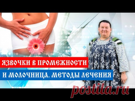 Молочница | Язвочки в промежности | Методы лечения | Арина Никитина
