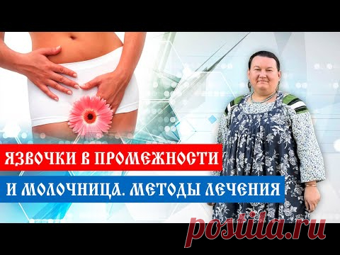 Молочница | Язвочки в промежности | Методы лечения | Арина Никитина