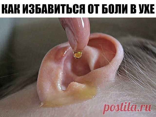 Ушная сера — желтое смолянистое вещество, вырабатывающееся в ушном канале, которое выполняет функцию природного антисептика и помогает вывести из уха отмерший эпителий. Часть серы выводится наружу в результате жевания или зевания, а часть остается.

Привычка очищать уши ватными палочками чревата утрамбовкой серы, что может привести к образованию серной пробки. Также неаккуратным движением ты рискуешь повредить барабанную перепонку.

От чрезмерного скопления серы в ухе може...