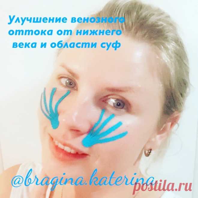 WELLNESS️ & ОСТЕОПАТИЯ в Instagram: «Отеки, мешки под глазами, суфы - это нарушение оттока межтканевой жидкости от области глаз! Причин может быть масса! Это и аллергические…» 325 отметок «Нравится», 10 комментариев — WELLNESS️ & ОСТЕОПАТИЯ (@bragina.katerina) в Instagram: «Отеки, мешки под глазами, суфы - это нарушение оттока межтканевой жидкости от области глаз! Причин…»